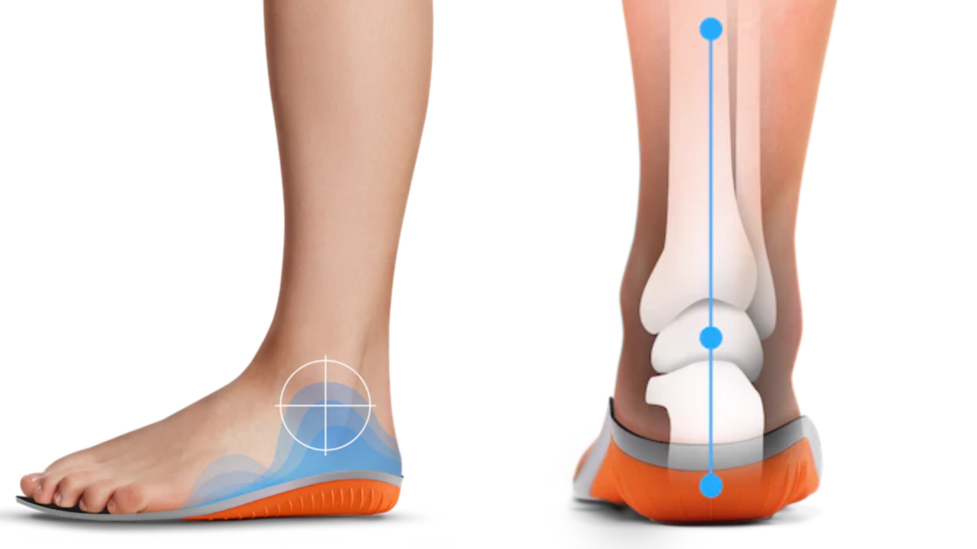 protalus insoles, arch support
