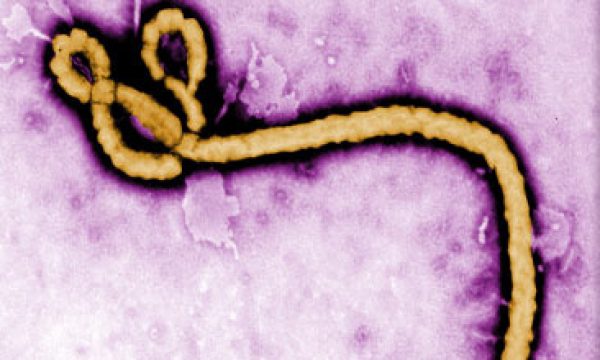 20140930170610Ebola_Virus